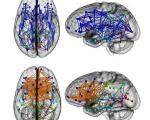 تفاوت جالب مغز مردان و زنان +عکس