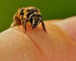 آلرژی به نیش زنبورها