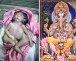 نوزادِ انسان چهارپا، خدای جدید هندی‌ها
