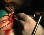آمار جراحی بینی در ایران هفت برابر آمریکا
