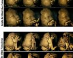 عکس های تکان دهنده از اثر سیگار بر جنین!