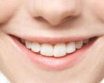 آرزو دارید دندانهایتان مثل هالیودی هازیباباشد؟