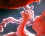 دوران بارداری و مرگ جنین