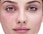 لک‌های پوستی چرا و چطور ظاهر می‌شوند؟