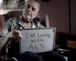 بیماری ALS (اسکلروز جانبی آمیوتروفیک) چیست؟