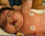 تصویر سنگین ترین نوزاد آلمانی به وزن 6 کیلو و 235 گرم با 57 سانتیمتر قد