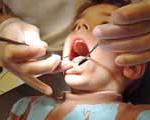 درمان ریشه به جای ‌كشیدن دندان