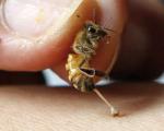 با نیش زنبور از شر این بیماری ها خلاص شوید!