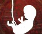 علل سقط جنین و علائم سقط جنین