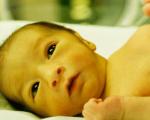 زردی نوزاد؛ از تشخیص تا درمان