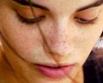 پنج روش برای از بین بردن لک های پوست