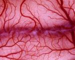 تولید رگ‌های خونی مصنوعی با دوام از سلولهای بنیادی