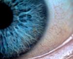 معکوس کردن روند نابینایی ناشی از دیابت با درمان جدید