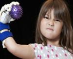 دختر بچه ای با دست رباتیک + تصویر