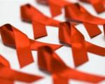27 هزار ایرانی چگونه به ایدز مبتلا شدند؟