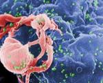 واکسن جدید ایدز از بدن یک مرد ۶۰ ساله