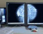 ماموگرافی به چه دردی می خورد؟