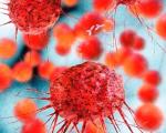 بیماران مبتلا به سرطان خون با ایمنی درمانی بهبود یافتند
