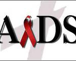 پروتئین بازدارنده ویروس ایدز کشف شد