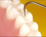 ورود فناوری جدید به عرصه دندانپزشكی