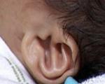 بااجسام خارجی داخل گوش بچه چه کنیم؟