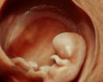 تصاویر زیبایی از حرکات جنین در رحم