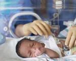 زایمان زود هنگام بر سلامت نوزاد تاثیر دارد