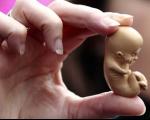 انواع سقط جنین و علایم و خطرات ناشی از سقط جنین