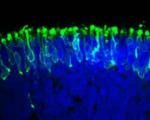 تولید چشم آزمایشگاهی حساس به نور با سلولهای بنیادی