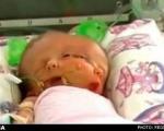 تولد دوقلوهایی با یک بدن و دو صورت در استرالیا(+عکس)