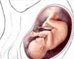 شانس بارداری بعد از سقط جنین چقدر است؟