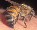 خطرات و عوارض زنبور گزیدگی و اقدامات درمانی جهت آن