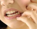 برنامه‌ وزارت بهداشت برای "دهانی عاری از دندان پوسیده" در دانش‌آموزان