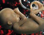 آلودگی هوا سقط جنین را افزایش می‌دهد