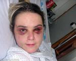 ضرب و شتم وحشیانه زن توریست پس از ساعت‌ها تعرض/جنایتکار پس از 5 سال لو رفت+تصاویر