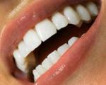 اسراری برای حفظ سفیدی دندان ها