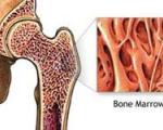 محققان موفق به ساخت استخوان از سلول بنیادین شدند