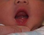 نوزادانی که موقع تولد دندان دارند !