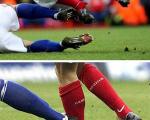 وحشتناک ترین آسیب دیدگی های تاریخ فوتبال+تصاویر
