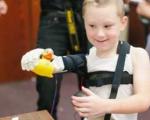 تصاویری از پیوند بازوی رباتیک چاپ شده به پسر 6 ساله