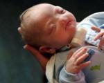 تولد یک نوزاد بدون بینی (+تصاویر)
