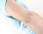 درمان  خانگی برای لطافت پوست آرنج و زانو