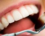 5 راهکار ساده برای داشتن دندان‌های سالم