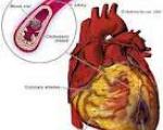 حملات قلبی در ساعات 1 و 5 بامداد صورت می گیرد