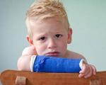 نکات مهم درباره شکستگی استخوان کودکان