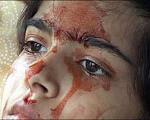 تصاویر شگفت انگیز دختری که خون گریه می کند!
