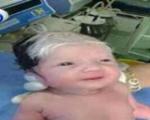 نوزادی که پیرمرد به دنیا آمد! +عکس