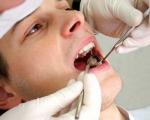 خرابی دندان ها منجر به آلزایمر می شود