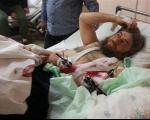 رهبر داعش در بیمارستان ترکیه (+عکس)