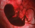روش جدید تشخیص تالاسمی از دوران جنینی